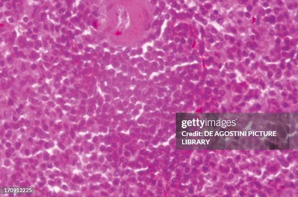 Lymph Node In Microscope Lymph Node Microscope Photos and Premium High Res Pictures - Getty Images