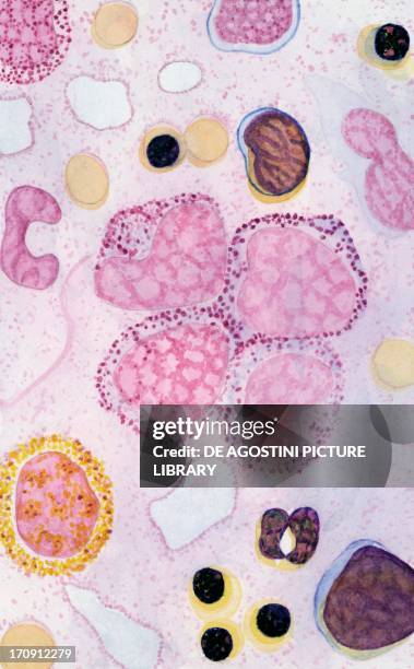 Sections of bone marrow tissue. Drawing.