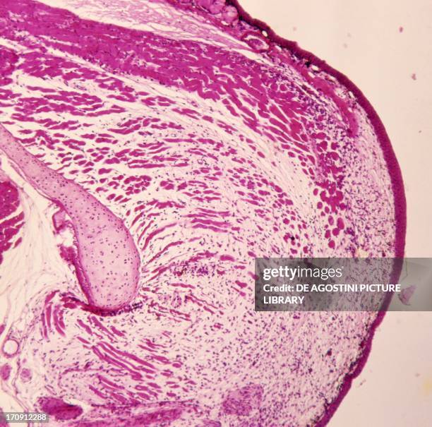 Counterstaining 35 Counterstaining Stock Photos, High-Res Pictures, and Images - Getty ...