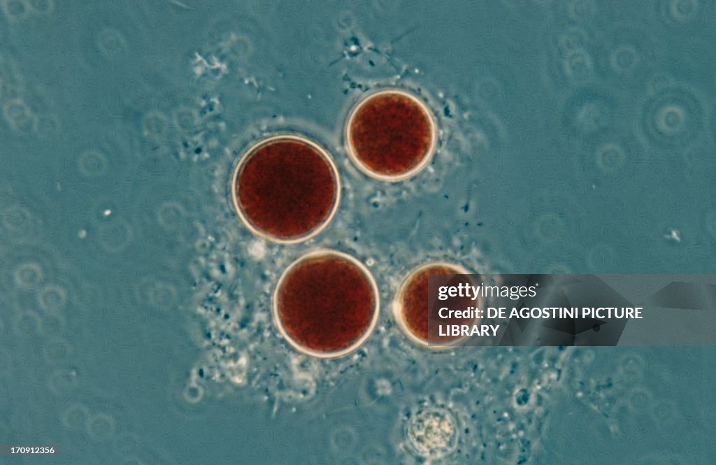 Haematococcus pluvialis protozoon...