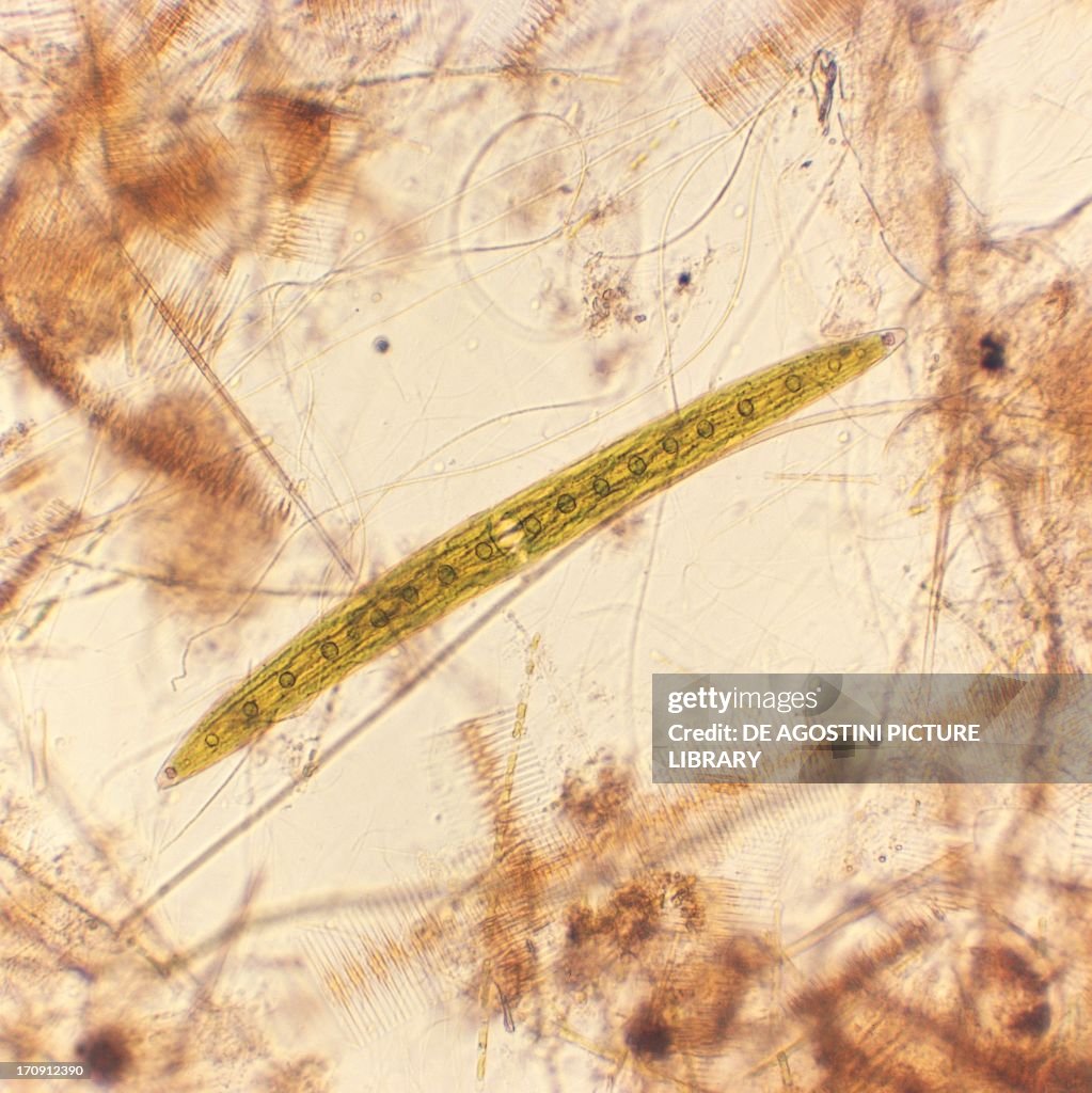 Colonies of algae diatoms...