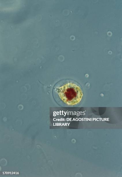 Protozoan, Haematococcus pluvialis.