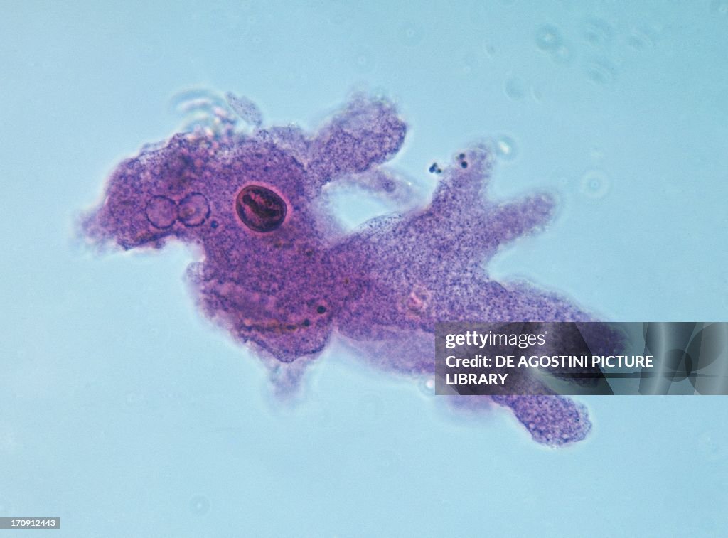 Microphotograph of amoeba (Amoeba proteus)...