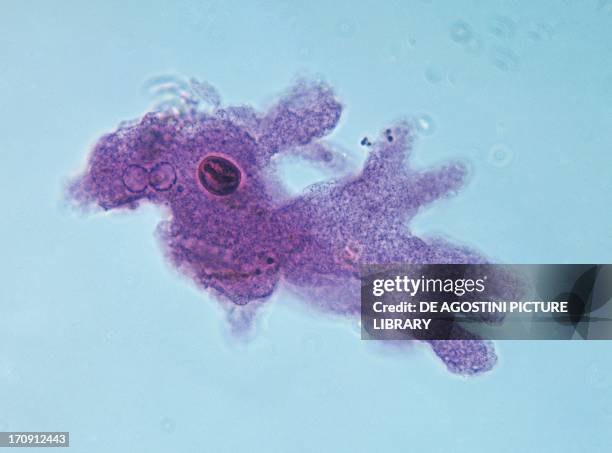Microphotograph of amoeba , Protozoan, seen with counterstaining, at x160 magnification.