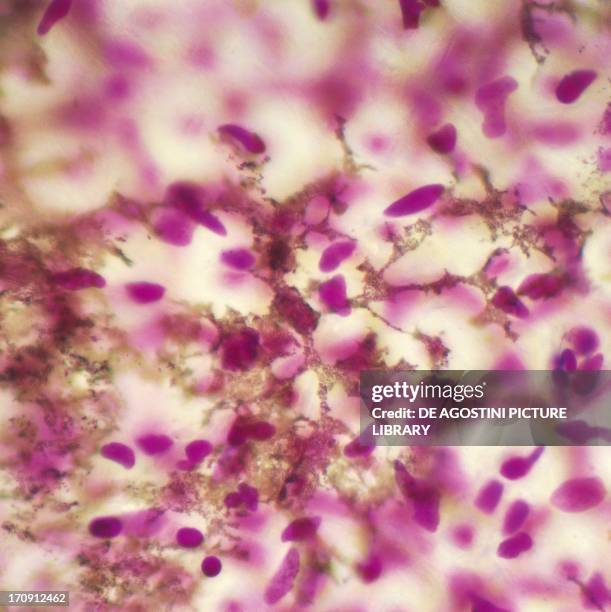 Counterstaining 35 Counterstaining Stock Photos, High-Res Pictures, and Images - Getty ...
