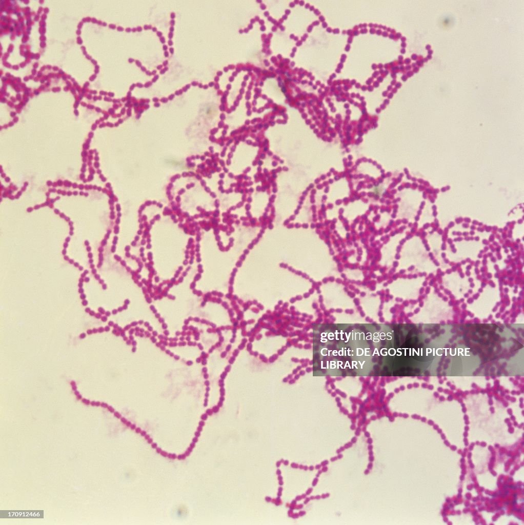 Formation of chains of bacteria, streptococci seen under a microscope ...