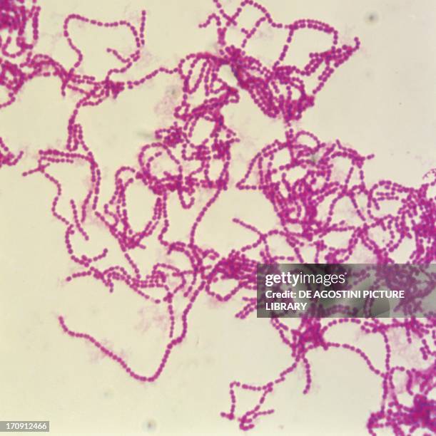 Counterstaining 35 Counterstaining Stock Photos, High-Res Pictures, and Images - Getty ...