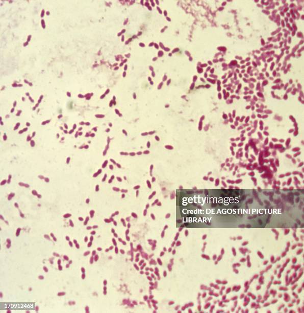 Microphotograph of diplococcus, bacterium responsible for pneumonia.