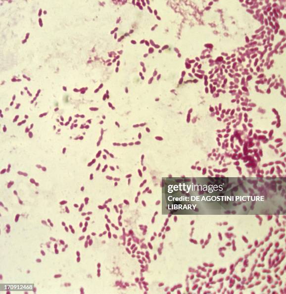 Diplococcus Example Microphotograph of diplococcus, bacterium responsible for pneumonia ...