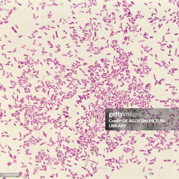 177 Shigella Stock Photos High Res Pictures And Images Getty Images 177-shigella-stock-photos-high-res-pictures-and-images-getty-images