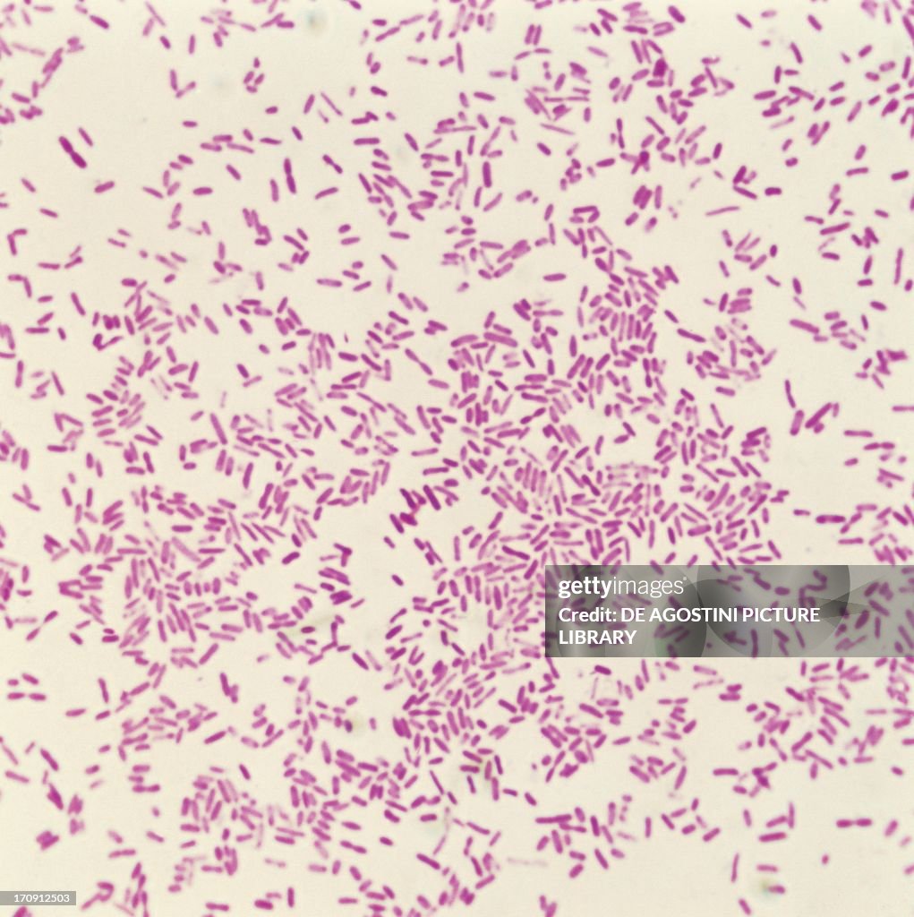 Shigella dysenteriae...