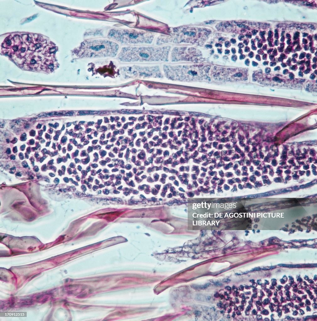 Longitudinal section of antheridia on moss