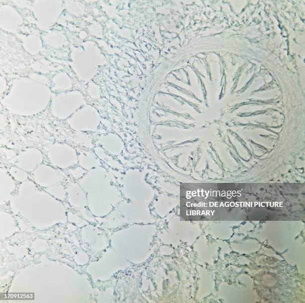 Phase Contrast Example 29 Phase Contrast Microscopy Stock Photos, High-Res Pictures, and ...