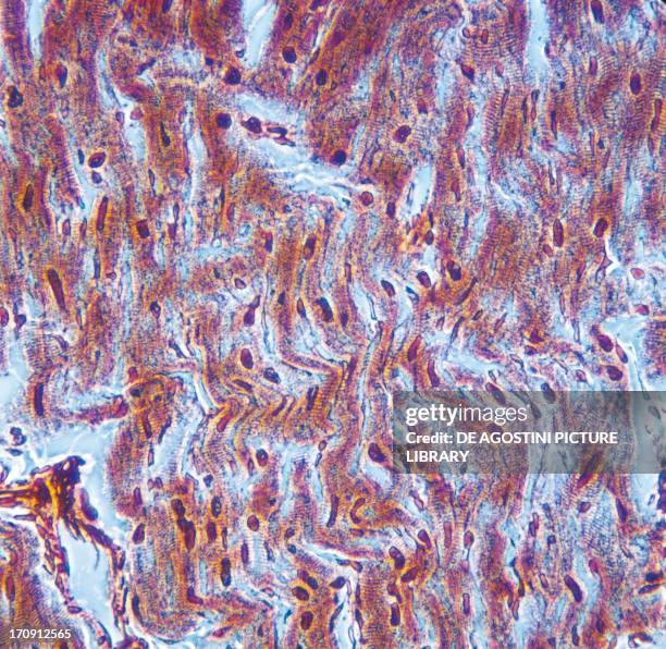 Section of human syncytium, striated myocardial muscle, seen under a microscope.