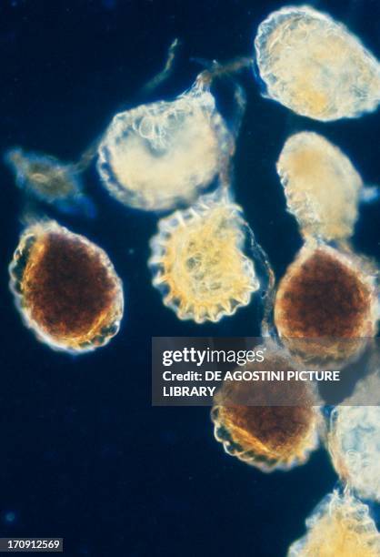 Microphotograph of a sporangium of Polypodiaceae fern.