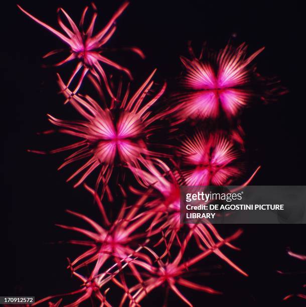 Stellate hairs of thorny olive , Elaeagnaceae, seen under a microscope with polarized light, at x75 magnification.