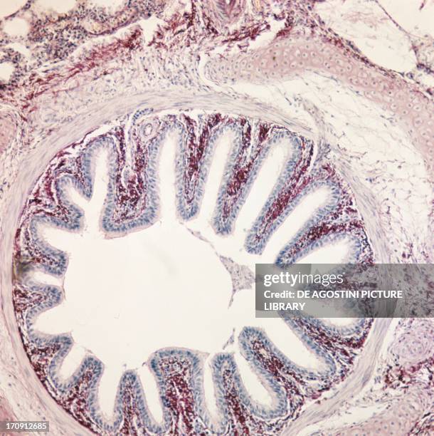 Counterstaining 35 Counterstaining Stock Photos, High-Res Pictures, and Images - Getty ...