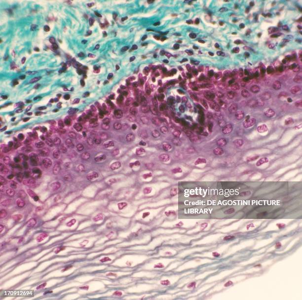 Squamous epithelial cell from a human vagina seen under a microscope, at x210 magnification.