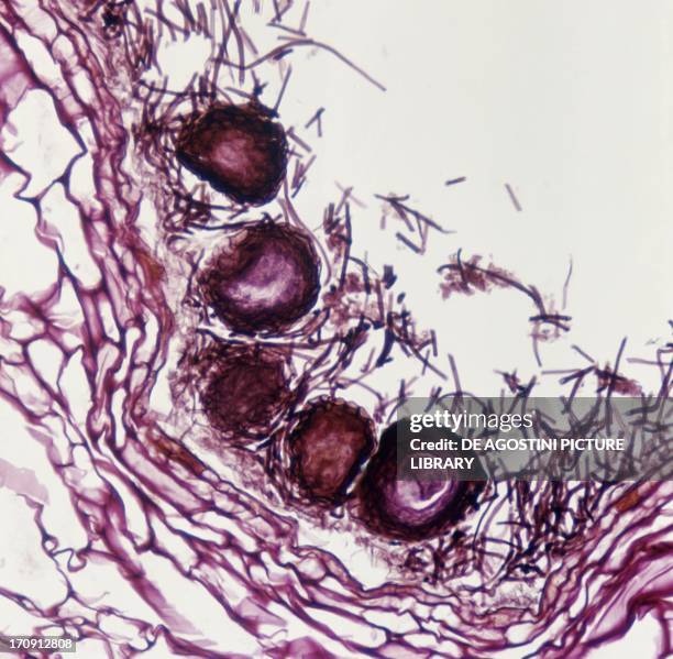 Microphotograph of powdery mildew caused by ascomycete fungi of the genus Sphaerotheca, at x90 magnification.