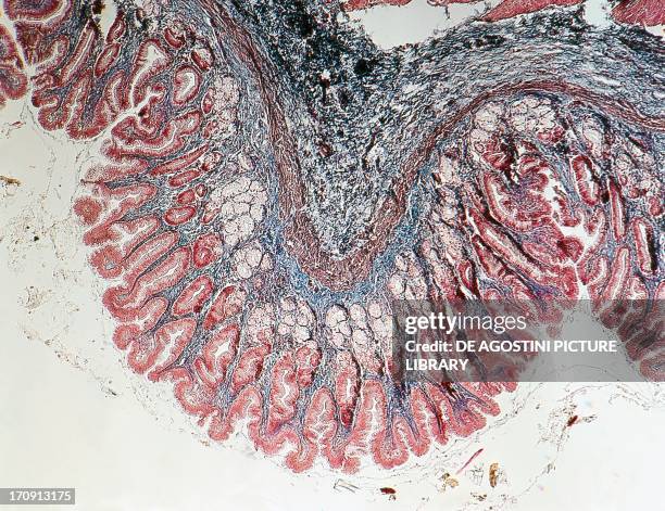 Duodedenum Under Microscope Duodenum Micrograph Foto e immagini stock - Getty Images
