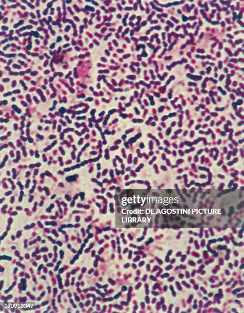 Diplococcus Microscope 322 Bacteria Under The Microscope Stock Photos, High-Res Pictures, and ...