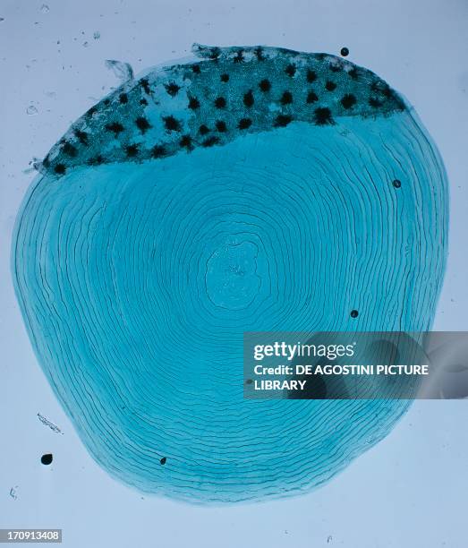 Microscopic Scale Photos and Premium High Res Pictures - Getty Images