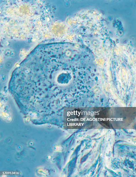 Epithelial cell from the human tongue seen with phase-contrast imaging under a microscope, seen at X615 magnification.