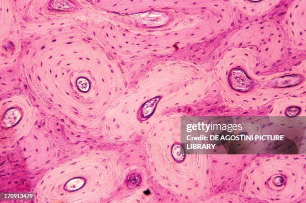Bone tissue, human femur, seen under a microscope.