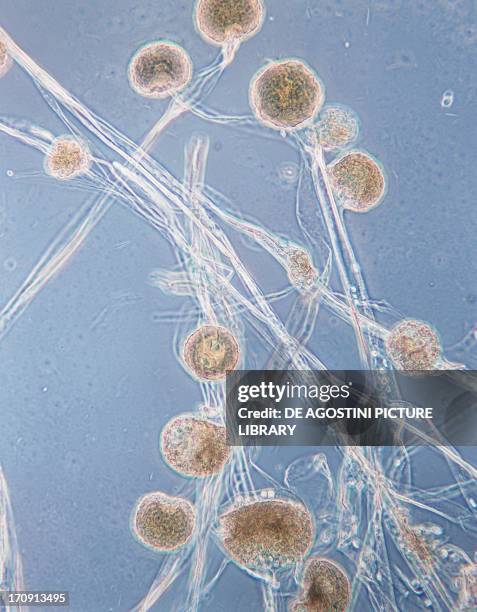 Mold Shape Microscope 302 Mold Under Microscope Stock Photos, High-Res Pictures, and Images ...