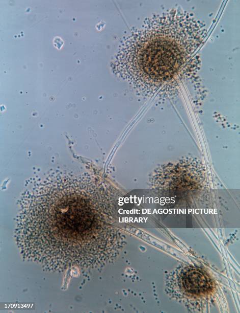 Aspergillus niger fungus, Ascomycetes, under an optical microscope.