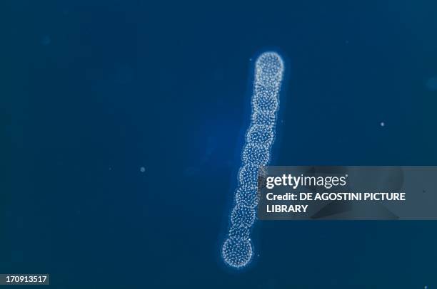 Radiolaria, Protozoan, seen under a microscope.