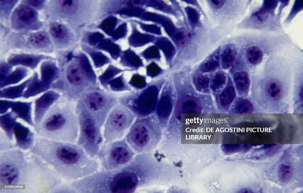 Culture of human ovarian granulosa...