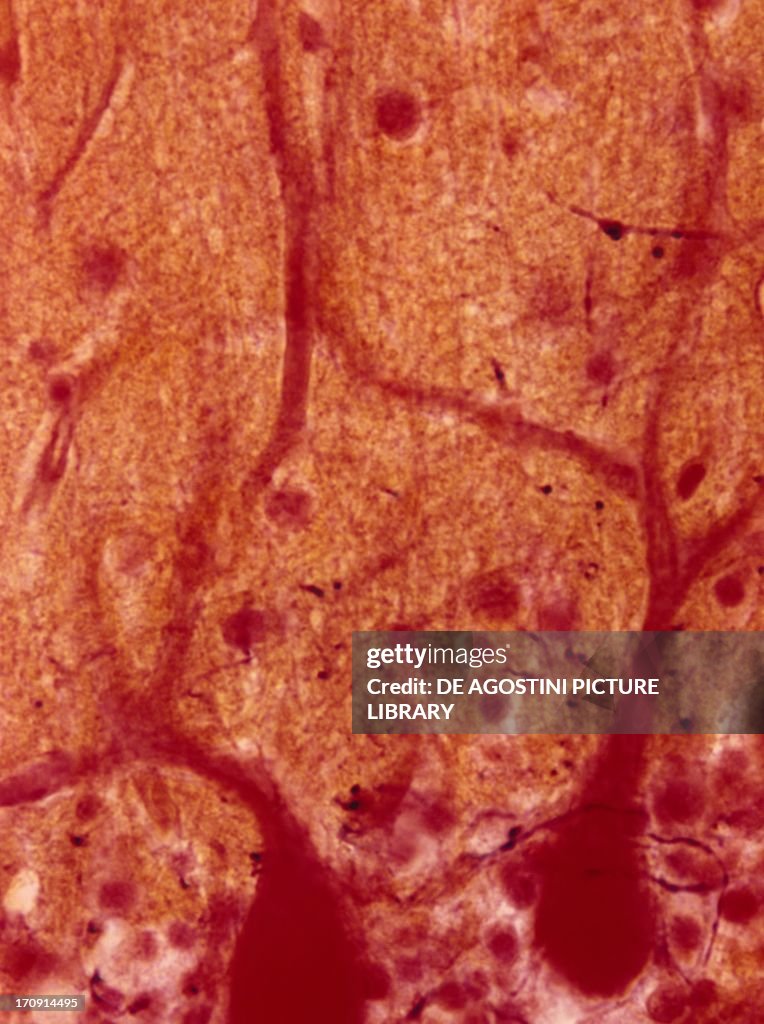 Human cerebellum with Purkinje cells