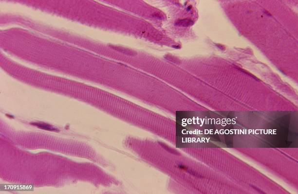 Microphotograph of a section of striated human muscle fibres at rest, at x400 magnification.