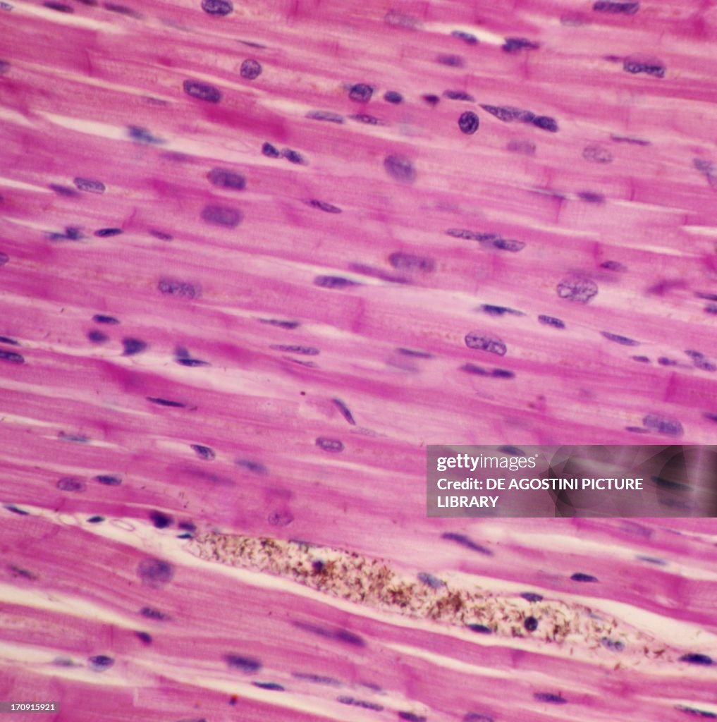 Cardiac Muscle Lab Cardiac Muscle Slide 400x Cardiac Muscle Histology Cardiac Muscle