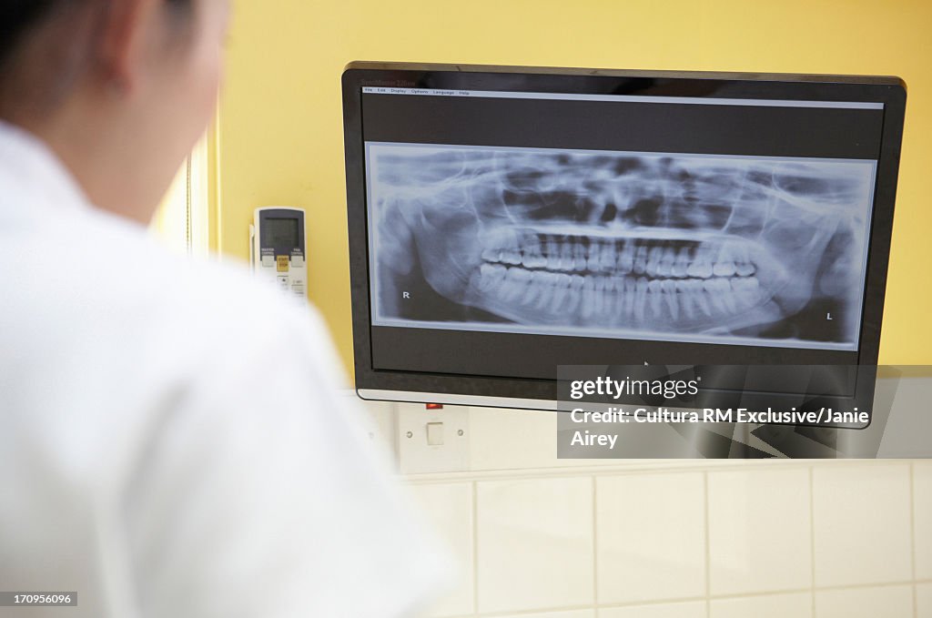 Dentist looking at xray of mouth