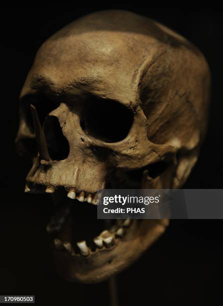 Skull of a man 35-40 years old killed with bone arrows. 3500 BC. Porsmose, Southern Zealand. National Museum of Denmark. Copenhagen. Denmark.