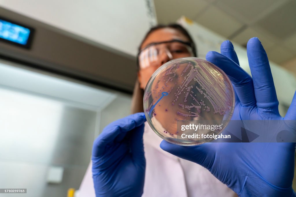 Woman researcher performing examination of bacterial culture plate