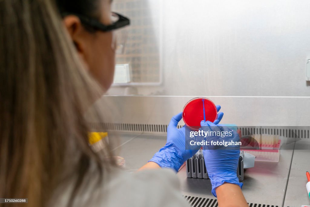 A laboratory technician who produces cultures works in the microbiology department at the hospital.