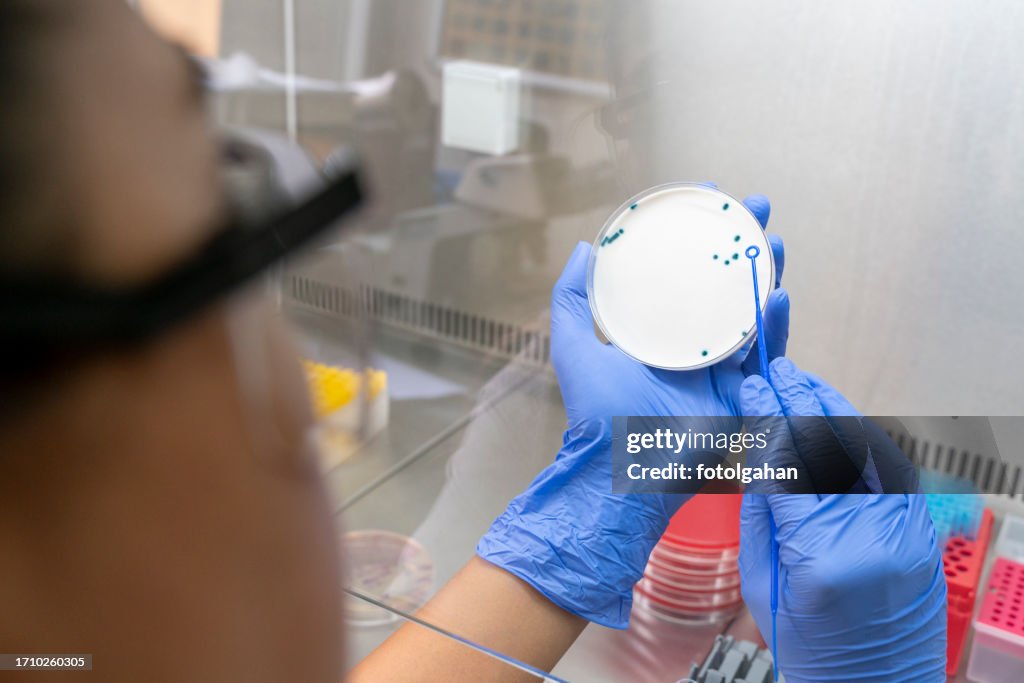 Woman researcher performing examination of bacterial culture plate