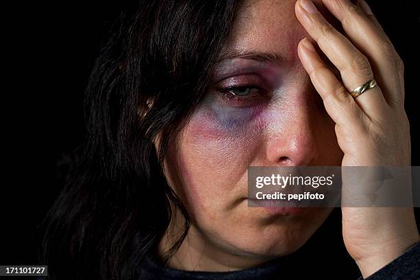 la violencia doméstica víctima - cardenal lesión física fotografías e imágenes de stock