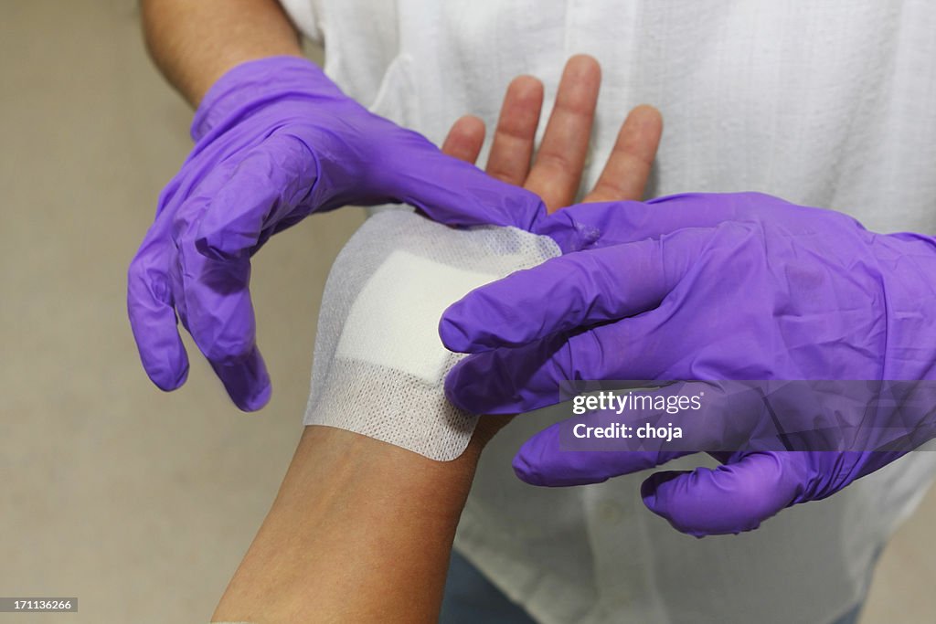 Patient after carpal tunnel syndrome operation at plastic surgery