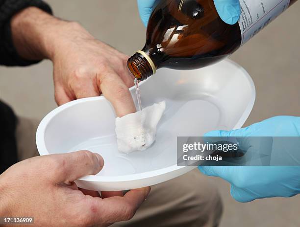 tiefe der wound.wounded patinet - wunde stock-fotos und bilder