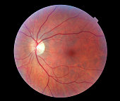 Image of a Human Retina