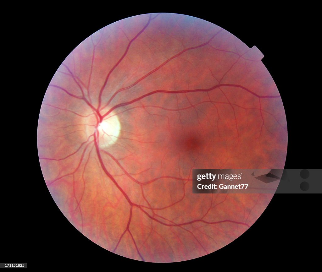 Image of a Human Retina