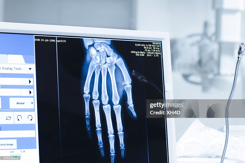 Analyse aux rayons x ou scann radiography dans hospital