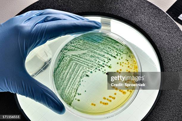 e.coli bacteria growing in dish - e coli stock pictures, royalty-free photos & images