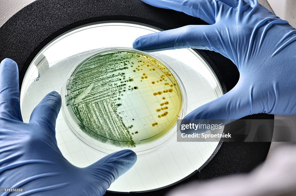 E.coli bacteria growing in dish inspected
