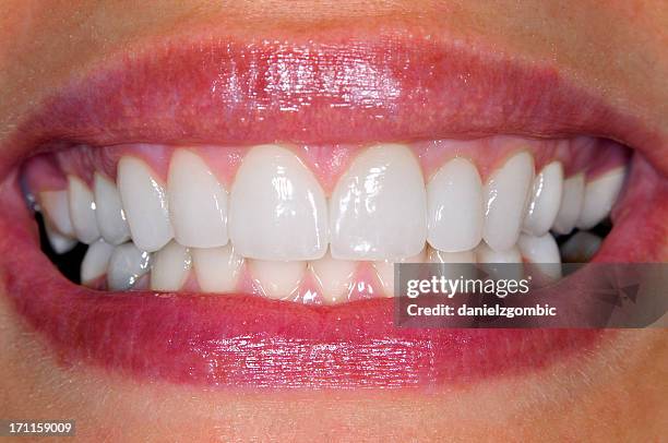 hermosa sonrisa - dientes humanos fotografías e imágenes de stock