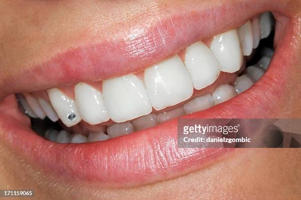 schönes lächeln mit circon - toothy smile stock-fotos und bilder
